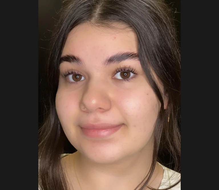 نمونه کار مادلینا- لیفت ابرو