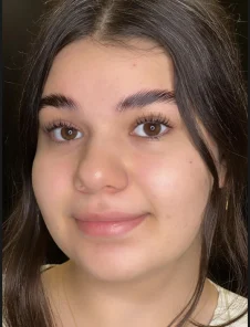 نمونه کار مادلینا- لیفت ابرو